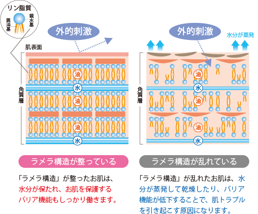 断面図